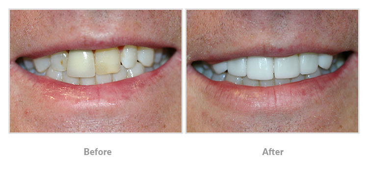 cosmetic patient